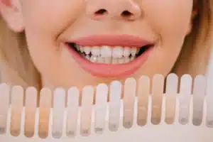 Myth The effect of teeth whitening lasts forever