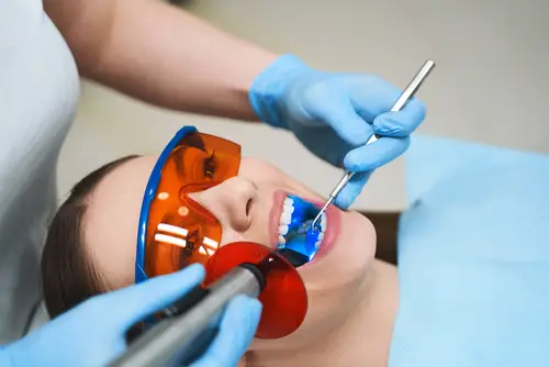 Teeth whitening Methods